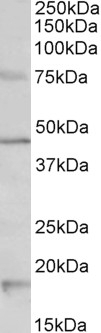 Alk Antibody