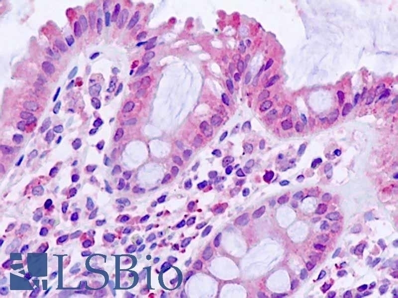 BTBD7 Antibody