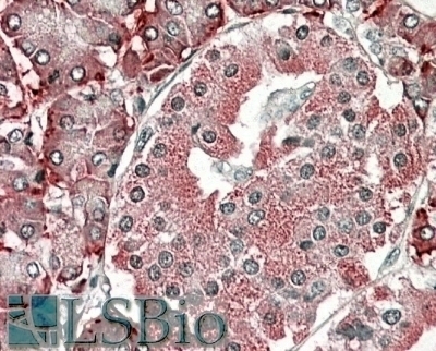 TXNDC5 Antibody