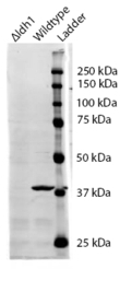 ACPP Antibody