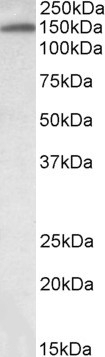 TXNDC11 Antibody