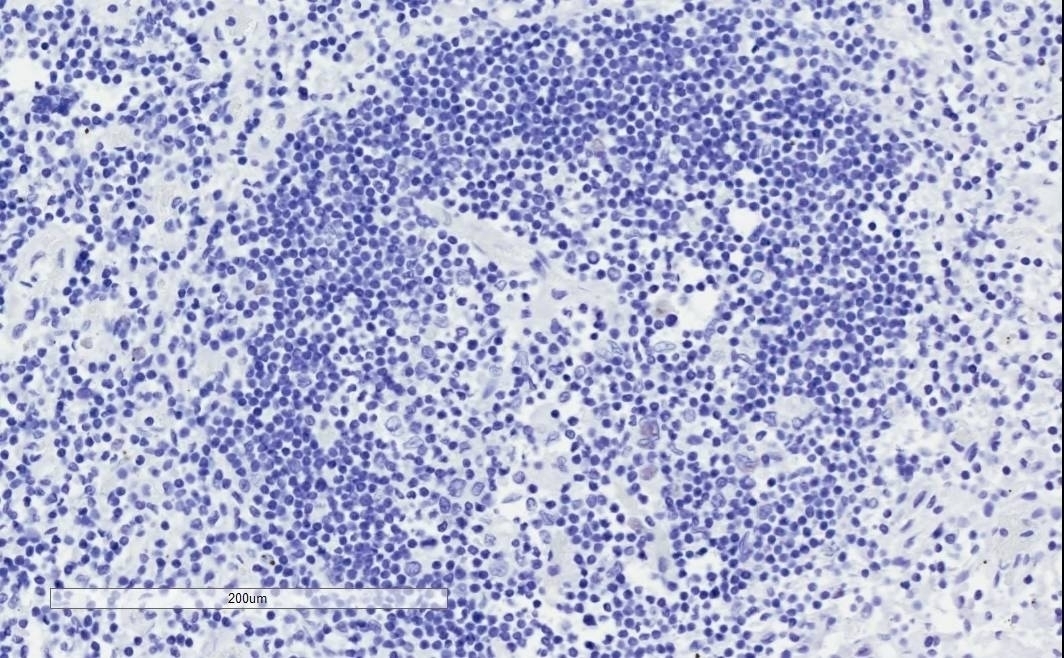 SH3GL1 Antibody