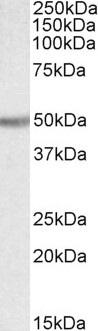 TXNDC5 Antibody