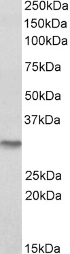 ABCC4 Antibody