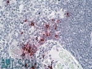 TSPYL2 Antibody