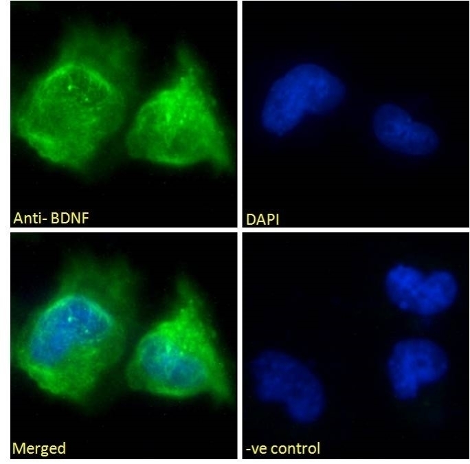 ACPP Antibody