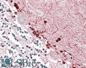 ATP1B1 Antibody