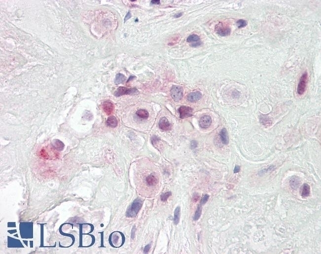 SLC12A2 Antibody