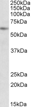 ACADVL Antibody