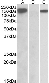 ALDH2 Antibody