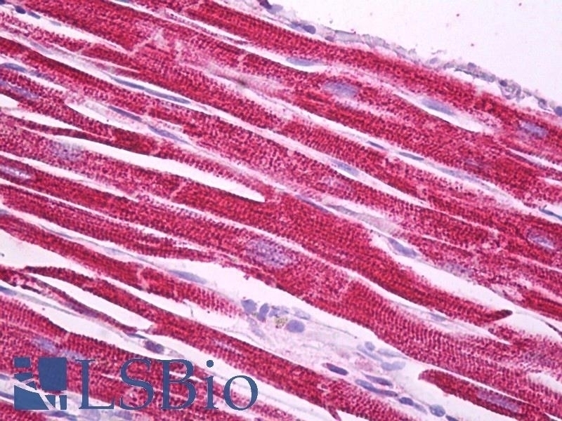 ALDH3A1 Antibody