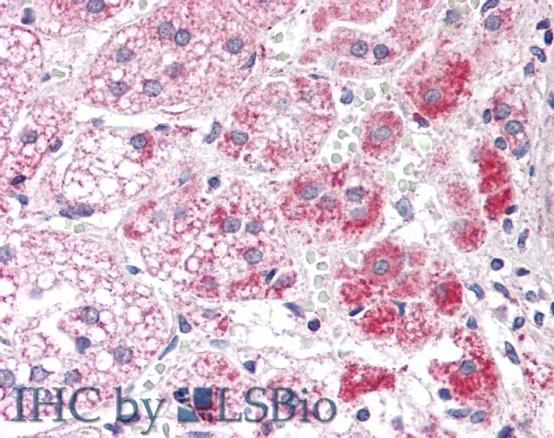 ALDH1B1 Antibody