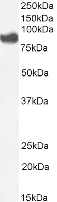 ALDH3B1 Antibody