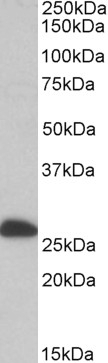 ALDH9A1 Antibody