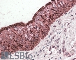 Aldh3a2 Antibody
