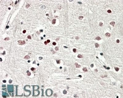 ATXN2 Antibody