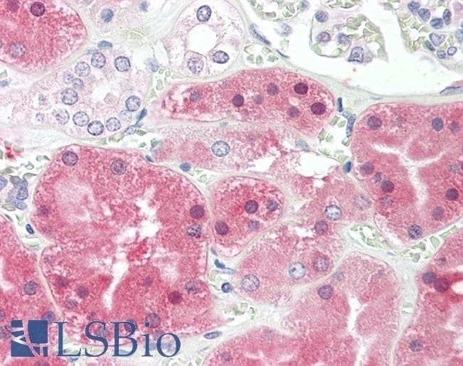 ARHGDIA Antibody