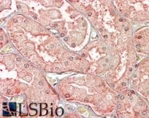 BCL2A1 Antibody