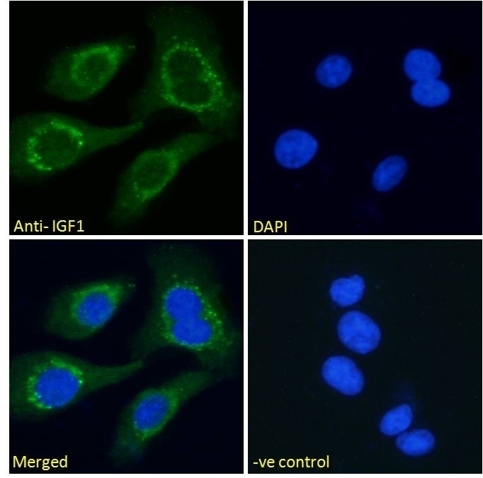 ALDH18A1 Antibody