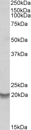 ALDH5A1 Antibody