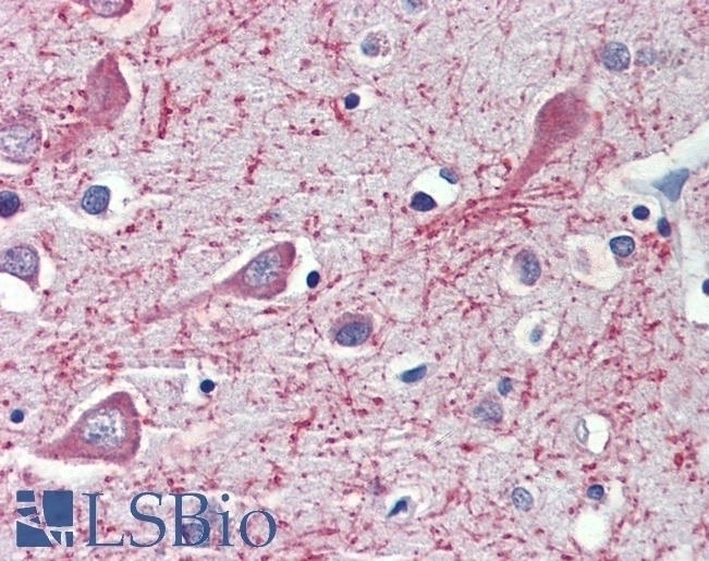 ALDH5A1 Antibody