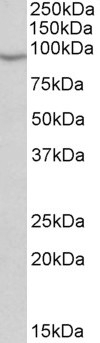 ALDH6A1 Antibody