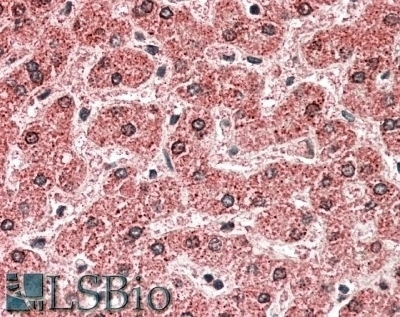 TRIM72 Antibody