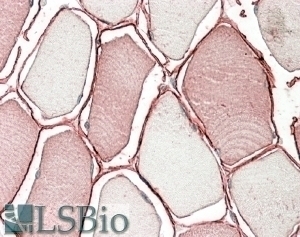 AGTPBP1 Antibody