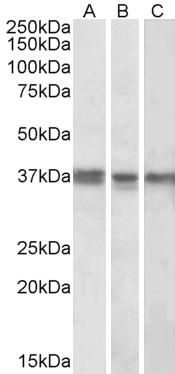 BBS4 Antibody