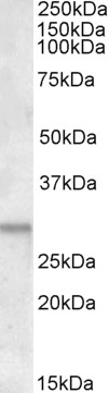 ATF5 Antibody