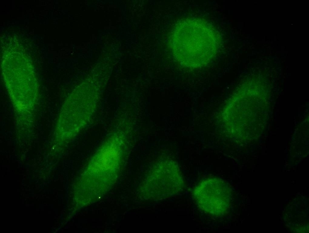 TRPV2 Antibody