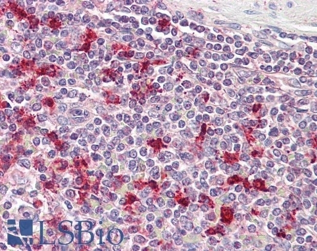 ARL4D Antibody