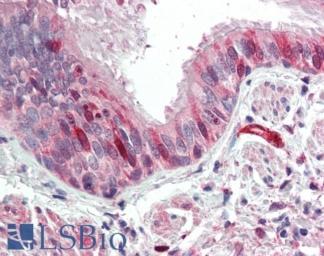 ACO1 Antibody