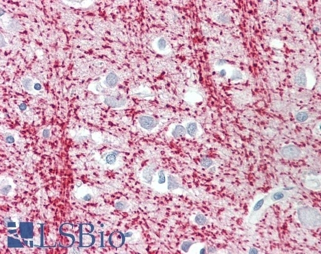 TPPP Antibody