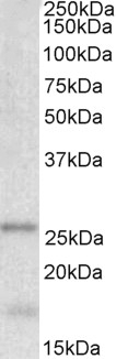 ARHGDIB Antibody