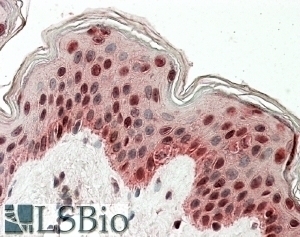 ARHGDIG Antibody