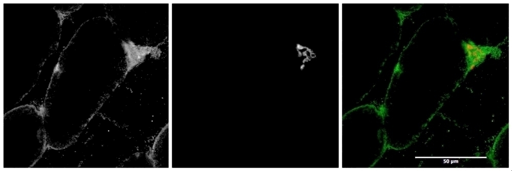 PRKAA2 Antibody