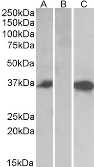 TIAM2 Antibody