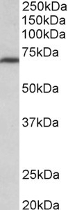 TPO Antibody