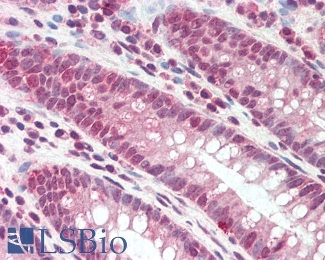 ATP2B1 Antibody
