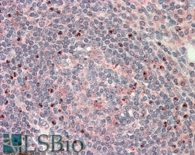 TRIM11 Antibody