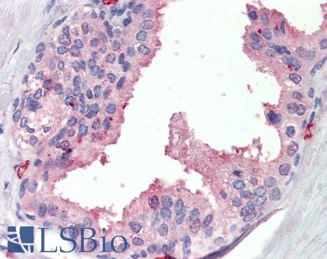 SLC6A8 Antibody