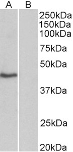 ZAP70 Antibody