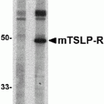Western blot analysis of TSLP Receptor in mouse heart tissue lysate with TSLP Receptor antibody at 1 μg/mL in (A) the presence and (B) the absence of blocking peptide.