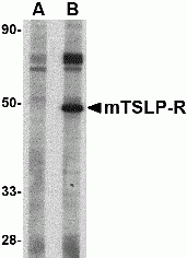TSLP Receptor Peptide