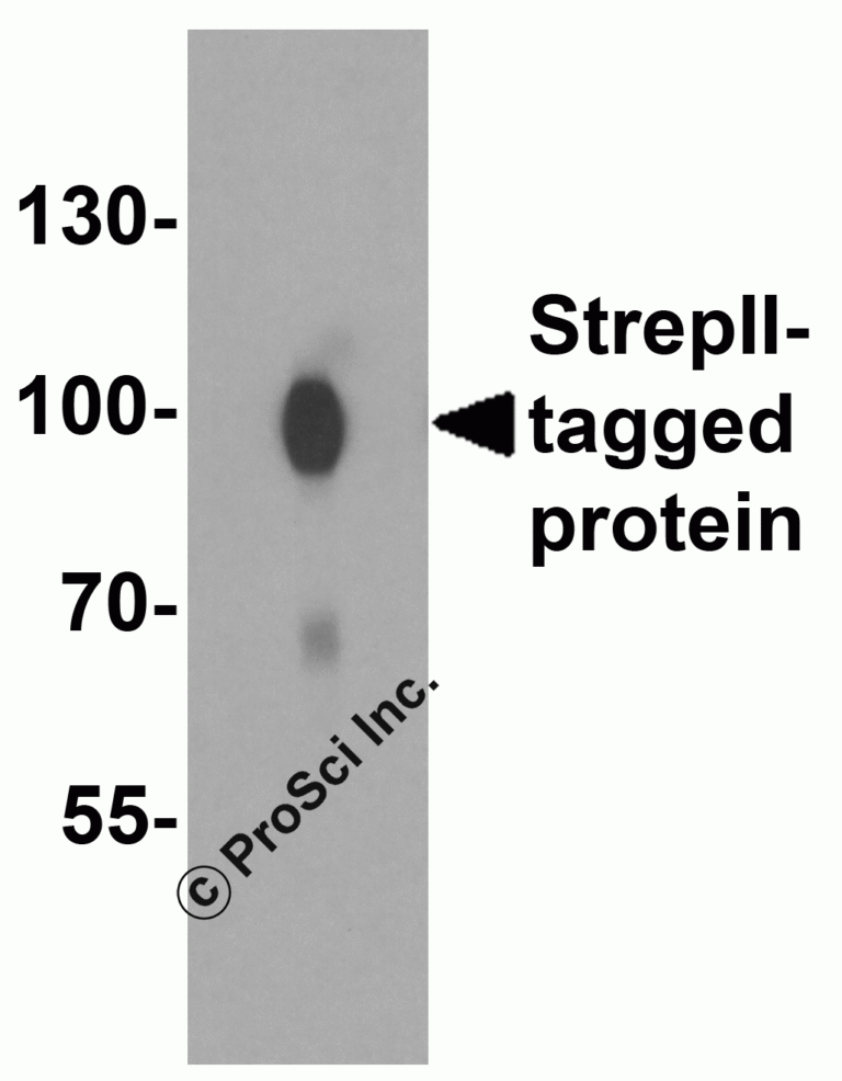Strep-tag II Peptide