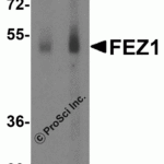 Western blot analysis of FEZ1 in SK-N-SH cell lysate with FEZ1 antibody at 1 μg/mL in the (A) presence and (B) absence of blocking peptide.