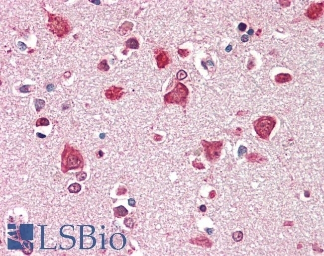LVA Antibody