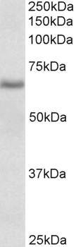 Stra6 Antibody