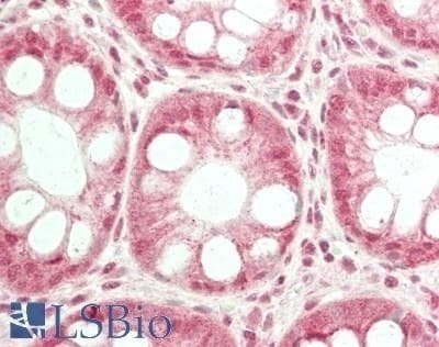 USP6 Antibody